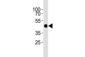 Western blot analysis of lysate from 12 tagged recombinant protein cell lines using HA antibody diluted at 1:1000. (HA-Tag 抗体)