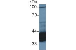 Detection of PDHb in Rat Cerebrum lysate using Polyclonal Antibody to Pyruvate Dehydrogenase Beta (PDHb)
