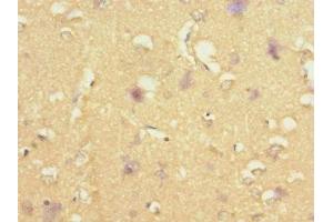 Immunohistochemistry of paraffin-embedded human brain tissue using ABIN7170732 at dilution of 1:100 (STRADA 抗体  (AA 25-210))