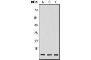 Western blot analysis of LY6E expression in HEK293T (A), Raw264. (LY6E 抗体  (Center))