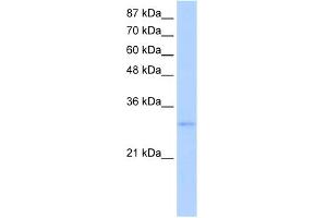WB Suggested Anti-EXOSC6 Antibody Titration:  5.