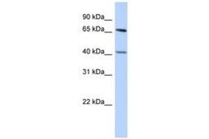 Image no. 1 for anti-Retinoblastoma Binding Protein 5 (RBBP5) (AA 431-480) antibody (ABIN6740370) (RBBP5 抗体  (AA 431-480))