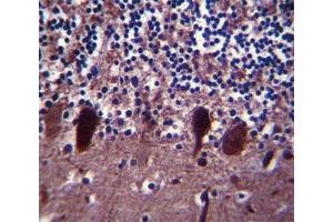 Immunohistochemistry (IHC) image for anti-Ubiquitin Carboxyl-terminal Esterase L1 (Ubiquitin Thiolesterase) (UCHL1) (AA 187-214) antibody (ABIN3029421)