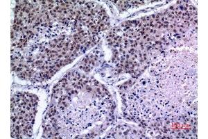 Immunohistochemistry (IHC) analysis of paraffin-embedded Human Lung, antibody was diluted at 1:100. (KLF13 抗体)
