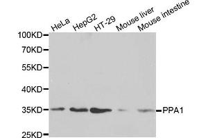 Western blot analysis of extracts of various cell lines, using PPA1 antibody. (Pyrophosphatase (Inorganic) 1 (PPA1) 抗体)