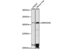 Western blot analysis of extracts of various cell lines, using DENND4A antibody (ABIN7266729) at 1:1000 dilution. (DENND4A 抗体  (AA 1500-1650))