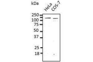 Endogenous CDHI detected with anti-CDH1at 1/500 dilution, lysate at 100 µg per Iane and rabbit polyclonal to goat lgG (HRP) at 1/10,00 dilution. (E-cadherin 抗体)