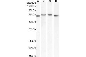 Western Blotting (WB) image for anti-Transforming Growth Factor, beta-Induced, 68kDa (TGFBI) (Internal Region) antibody (ABIN571098)