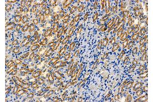 ABIN6262851 and ABIN6277626 at 1/100 staining Rat kidney tissue by IHC-P. (Kallikrein 7 抗体  (Internal Region))