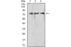 Western blot analysis using RIPK1 mouse mAb against HL-60 (1), K562 (2), and Jurkat (3) cell lysate. (RIPK1 抗体  (AA 131-277))