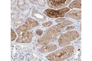 ABIN6266730 at 1/100 staining human kidney tissue sections by IHC-P. (TRIM16 抗体  (N-Term))