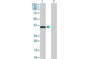 Western Blot analysis of BRDG1 expression in transfected 293T cell line by BRDG1 monoclonal antibody (M01), clone 5A10.