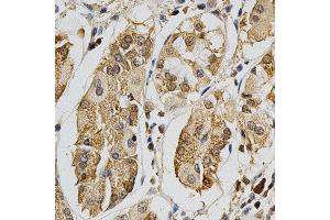 Immunohistochemistry of paraffin-embedded human stomach using MAPK10 antibody at dilution of 1:200 (x400 lens) (MAPK10 抗体  (AA 175-464))