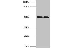 Western blot All lanes: IDH2 antibody at 5 μg/mL Lane 1: Hela whole cell lysate Lane 2: Mouse heart tissue Secondary Goat polyclonal to rabbit IgG at 1/10000 dilution Predicted band size: 51, 46 kDa Observed band size: 51 kDa (IDH2 抗体  (AA 193-452))