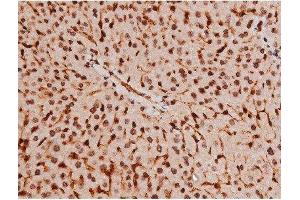 Immunohistochemistry (IHC) image for anti-Signal Transducer and Activator of Transcription 3 (Acute-Phase Response Factor) (STAT3) (pTyr705) antibody (ABIN6255995)