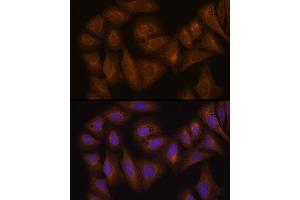 Immunofluorescence (IF) image for anti-Glutathione S-Transferase alpha 1 (GSTA1) (AA 1-222) antibody (ABIN7267439)