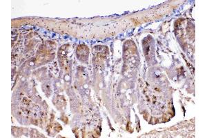 IHC analysis of ADA using anti-ADA antibody . (ADA 抗体  (AA 2-241))