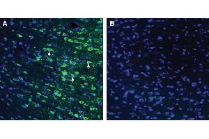 Expression of GPR18 in rat cingulate cortex. (GPR18 抗体  (Extracellular))
