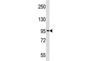 PROX1 antibody western blot analysis in A2058 lysate (PROX1 抗体  (AA 492-522))