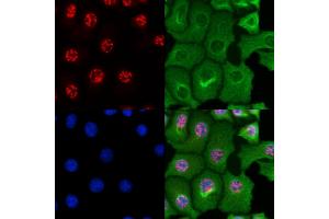 ABIN6264437 and ABIN6269102 staining HepG2 cells by IF/ICC.