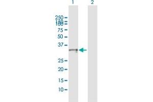 Western Blotting (WB) image for anti-Corticotropin Releasing Hormone Binding Protein (CRHBP) (AA 1-322) antibody (ABIN514596)