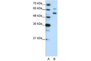 WDR4 antibody used at 1. (WDR4 抗体  (C-Term))