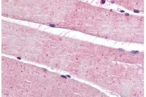 Immunohistochemistry (Formalin/PFA-fixed paraffin-embedded sections) of human skeletal muscle tissue with BEST3 polyclonal antibody . (Bestrophin 3 抗体  (C-Term))