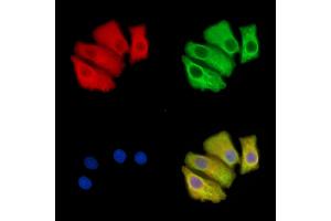 ABIN7095634 and ABIN7099696 staining Hela cells by IF/ICC.