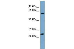 WB Suggested Anti-LRRC6 Antibody Titration: 0. (LRRC6 抗体  (N-Term))