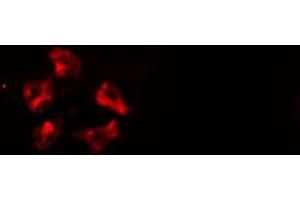 ABIN6277118 staining  HeLa cells by IF/ICC. (Cullin 1 抗体)