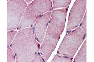 Immunohistochemistry (IHC) image for anti-Sarcoglycan, epsilon (SGCE) (N-Term) antibody (ABIN2782610) (SGCE 抗体  (N-Term))