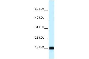 Western Blot showing CALML3 antibody used at a concentration of 1 ug/ml against Hela Cell Lysate (CALML3 抗体  (Middle Region))