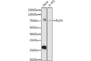 Western blot analysis of extracts of various cell lines, using FLCN antibody (ABIN6133517, ABIN6140670, ABIN6140672 and ABIN6222156) at 1:1000 dilution.