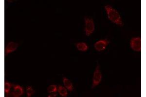 Immunofluorescence (fixed cells) (IF/ICC) image for anti-EGF-Like Module Containing, Mucin-Like, Hormone Receptor-Like Sequence 4 (EMR4) antibody (ABIN6259597)