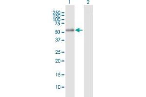 Western Blot analysis of ALDH7A1 expression in transfected 293T cell line by ALDH7A1 MaxPab polyclonal antibody.