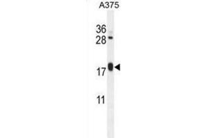 Western Blotting (WB) image for anti-ADP-Ribosylation Factor-Like 8A (ARL8A) antibody (ABIN2995545) (ARL8A 抗体)