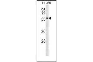 Western blot analysis of ONECUT1 Antibody (C-term) in HL-60 cell line lysates (35ug/lane). (ONECUT1 抗体  (C-Term))