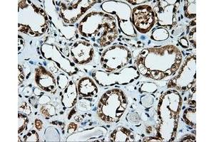 Immunohistochemical staining of paraffin-embedded Kidney tissue using anti-KIAA1609 mouse monoclonal antibody. (KIAA1609 抗体)