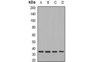 Western blot analysis of TIRAP expression in HT29 (A), SW480 (B), mouse liver (C), mouse brain (D) whole cell lysates. (TIRAP 抗体)