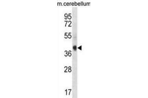 Western Blotting (WB) image for anti-AKT Interacting Protein (AKTIP) antibody (ABIN3000901) (AKTIP 抗体)