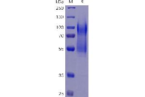 Human CD34 Protein, His Tag on SDS-PAGE under reducing condition.