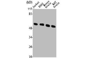 Western Blot analysis of Jurkat K562 MOUSE-BRAIN RAT-BRAIN cells using Tubulin β Polyclonal Antibody (TUBB3 抗体  (C-Term))