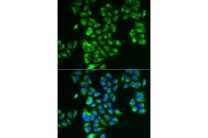 Immunofluorescence analysis of A549 cells using GLUD2 antibody.