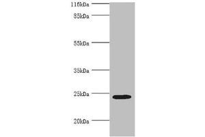 Western blot All lanes: MIS12 antibody at 2 μg/mL + Hela whole cell lysate Secondary Goat polyclonal to rabbit IgG at 1/10000 dilution Predicted band size: 25 kDa Observed band size: 25 kDa (MIS12 抗体  (AA 1-305))