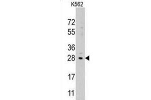 Western Blotting (WB) image for anti-Lin-28 Homolog B (LIN28B) antibody (ABIN2937586) (LIN28B 抗体)