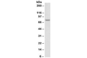 Western blot testing of Jurkat nuclear lysate with TDP1 antibody at 2ug/ml. (TDP1 抗体)