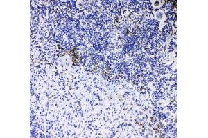 IHC analysis of CD8 alpha using anti-CD8 alpha antibody . (CD8 alpha 抗体  (AA 28-196))