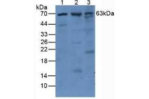 Western blot analysis of (1) Human Mcf7 Cells, (2) Mouse Pancreas Tissue and (3) Mouse Kidney Tissue. (PLAT 抗体  (AA 311-562))