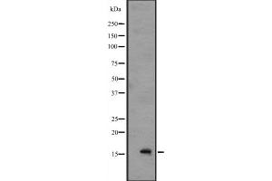 Western blot analysis of IL1F8 expression in A549 cell lysate with blocking peptide,The lane on the left is treated with the antigen-specific peptide. (FIL1h 抗体  (C-Term))