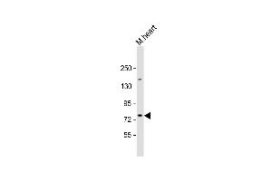 Anti-SLC6A8 Antibody (N-Term) at 1:2000 dilution + mouse heart lysate Lysates/proteins at 20 μg per lane. (SLC6A8 抗体  (AA 180-212))